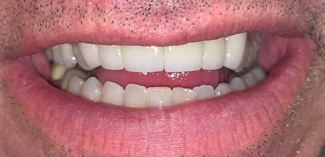 Close up of man with well aligned teeth