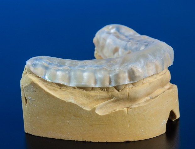 Model of mouth with clear nightguard resting on teeth
